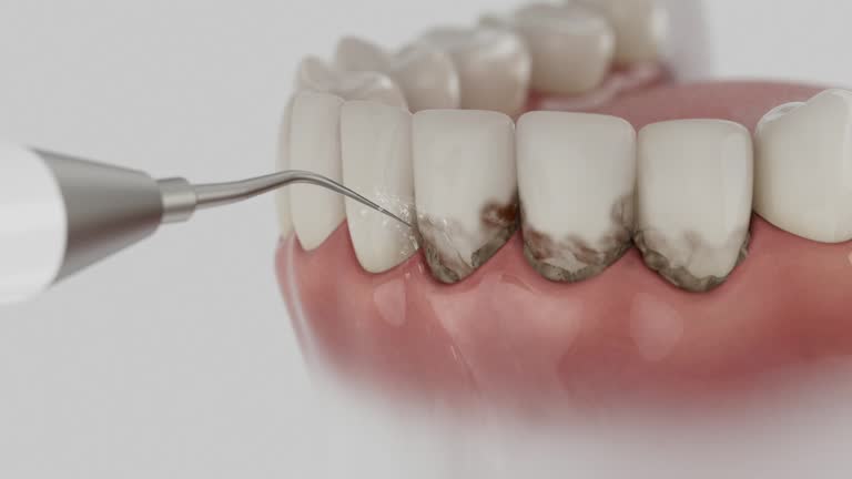 Reliable Dental contractor in Saint John Fisher College, NY by Dentist Open Now